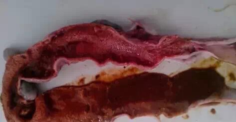 回肠粘膜